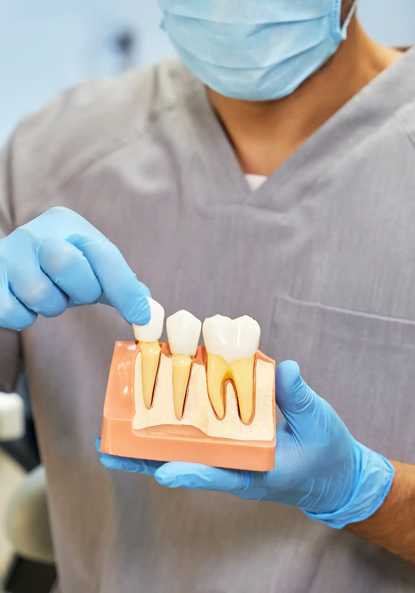 Dental Crowns