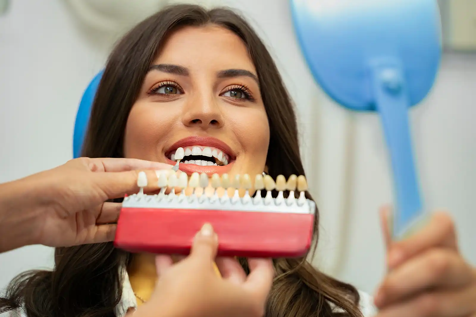 Veneers